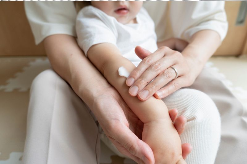 Managing The Itch: What Should Parents Know About  Childhood Eczema?